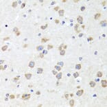 Immunohistochemistry - Anti-Chd1 Antibody (A15952) - Antibodies.com