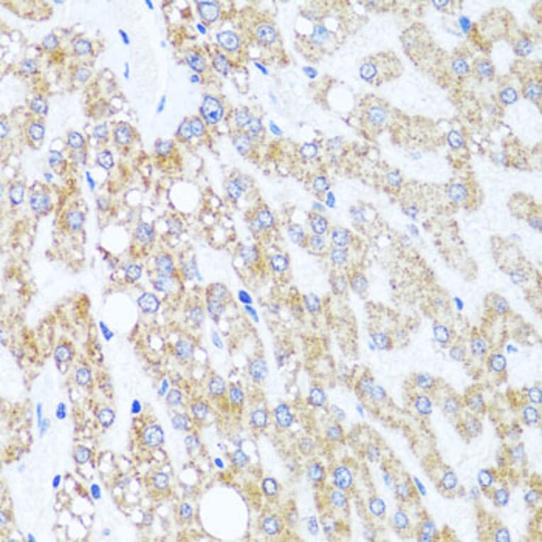 Immunohistochemistry - Anti-Chd1 Antibody (A15952) - Antibodies.com