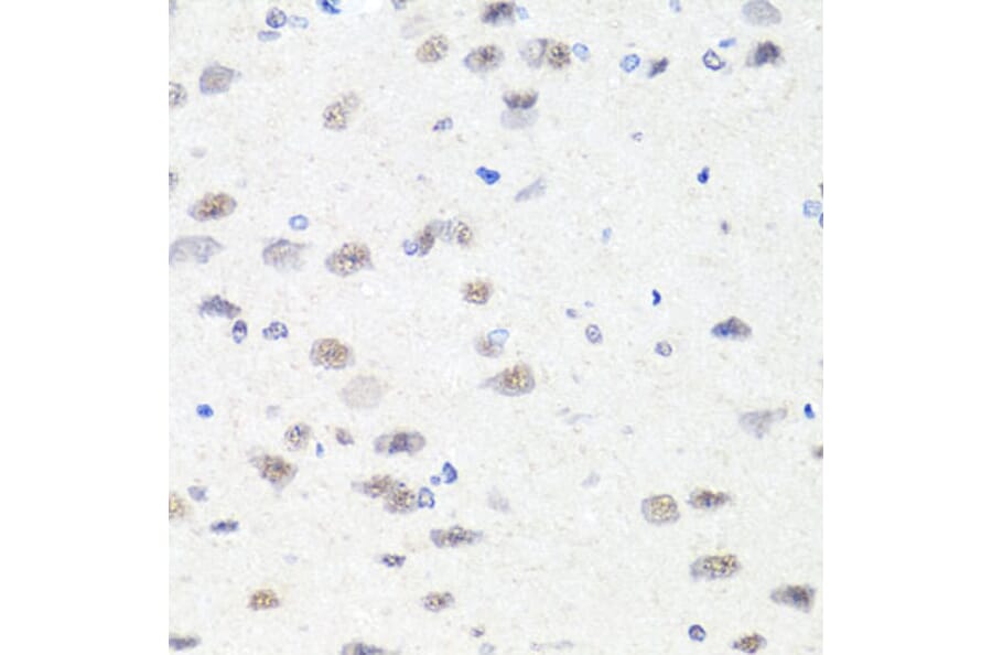 Immunohistochemistry - Anti-Chd1 Antibody (A15952) - Antibodies.com