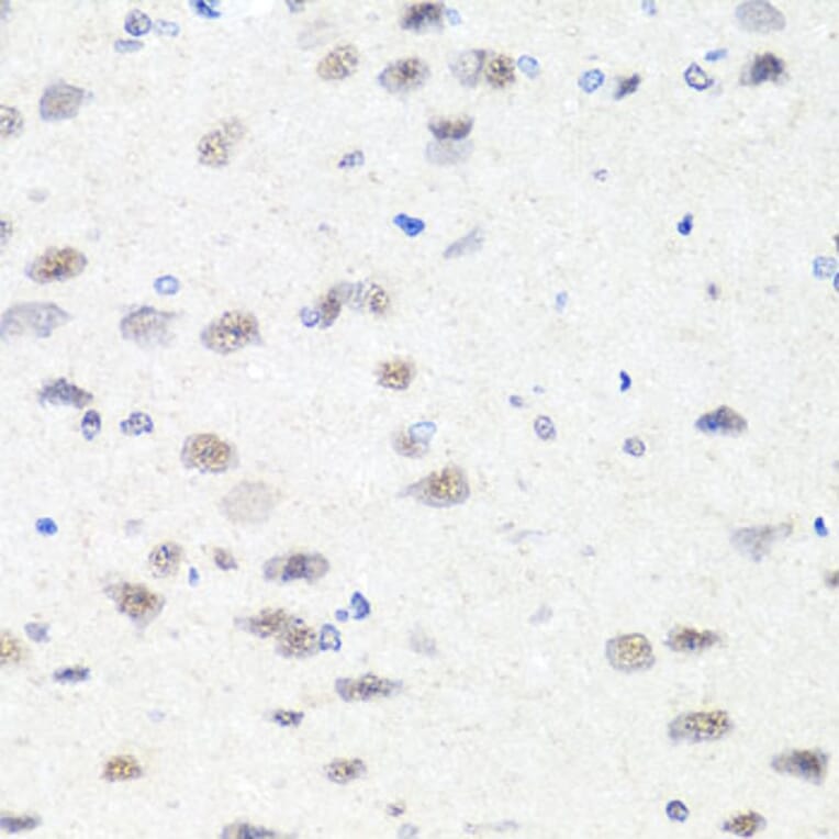 Immunohistochemistry - Anti-Chd1 Antibody (A15952) - Antibodies.com