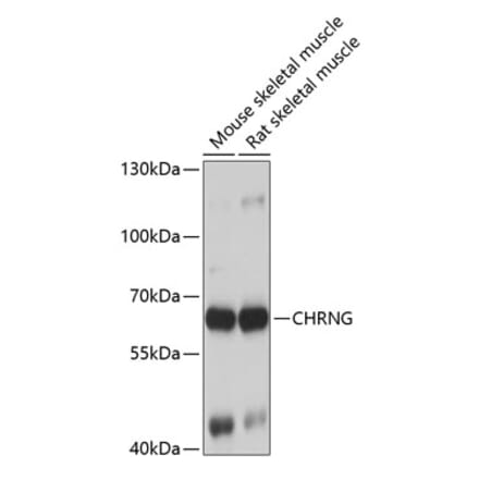 Western Blot - Anti-Nicotinic Acetylcholine Receptor gamma Antibody (A15953) - Antibodies.com