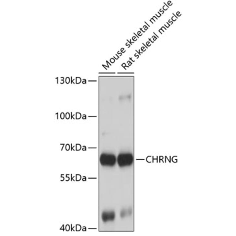 Western Blot - Anti-Nicotinic Acetylcholine Receptor gamma Antibody (A15953) - Antibodies.com