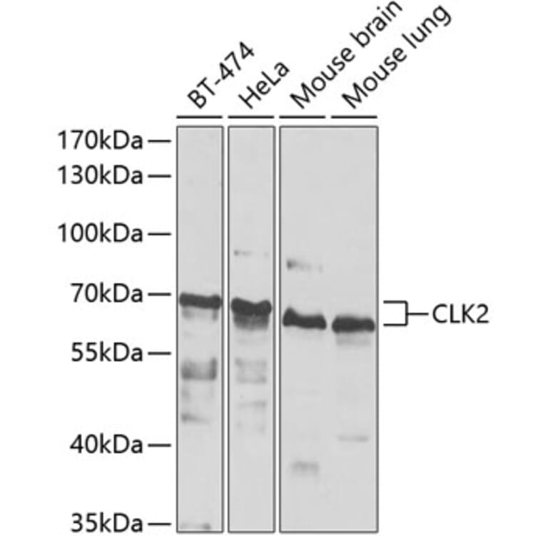 Western Blot - Anti-CLK2 Antibody (A15954) - Antibodies.com