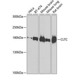 Western Blot - Anti-CLTC Antibody (A7886) - Antibodies.com