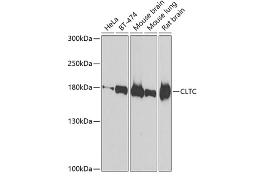 Western Blot - Anti-CLTC Antibody (A7886) - Antibodies.com