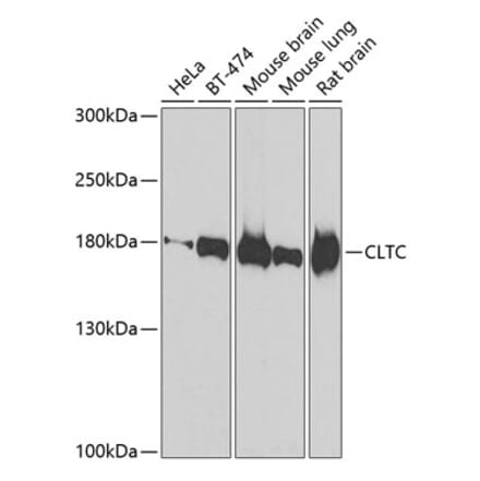 Western Blot - Anti-CLTC Antibody (A15955) - Antibodies.com
