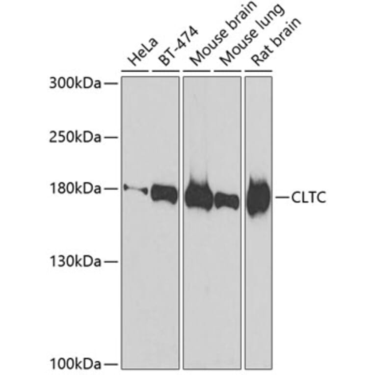 Western Blot - Anti-CLTC Antibody (A7886) - Antibodies.com