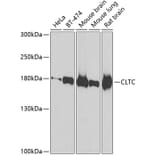 Western Blot - Anti-CLTC Antibody (A7886) - Antibodies.com