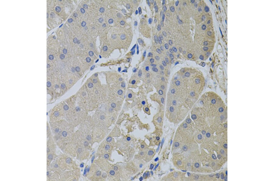 Immunohistochemistry - Anti-CLTC Antibody (A7886) - Antibodies.com