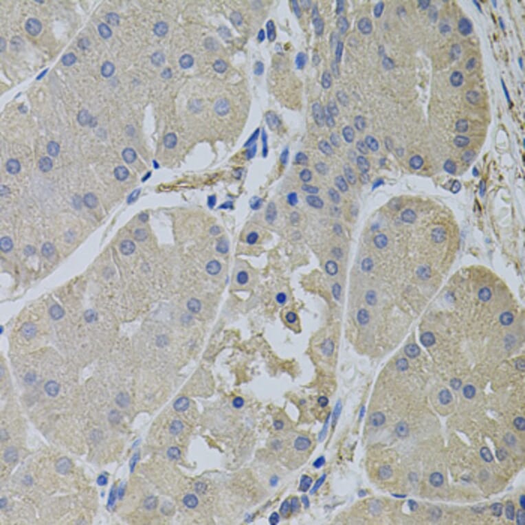 Immunohistochemistry - Anti-CLTC Antibody (A7886) - Antibodies.com