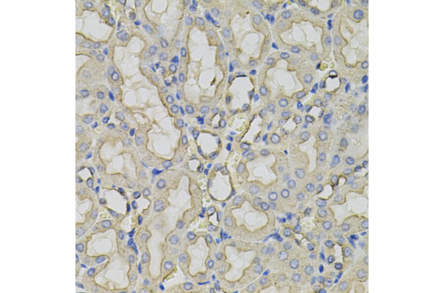 Immunohistochemistry - Anti-CLTC Antibody (A7886) - Antibodies.com
