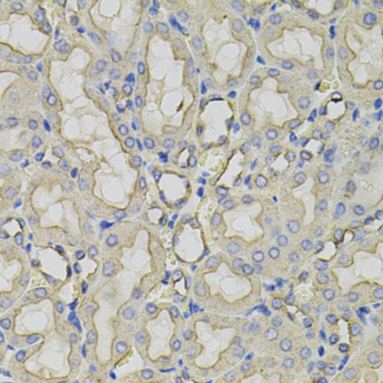Immunohistochemistry - Anti-CLTC Antibody (A7886) - Antibodies.com
