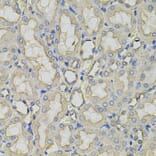 Immunohistochemistry - Anti-CLTC Antibody (A7886) - Antibodies.com