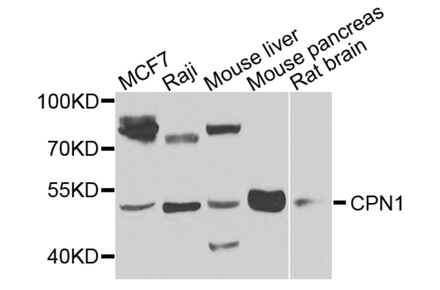 Western Blot - Anti-CPN1 Antibody (A7887) - Antibodies.com