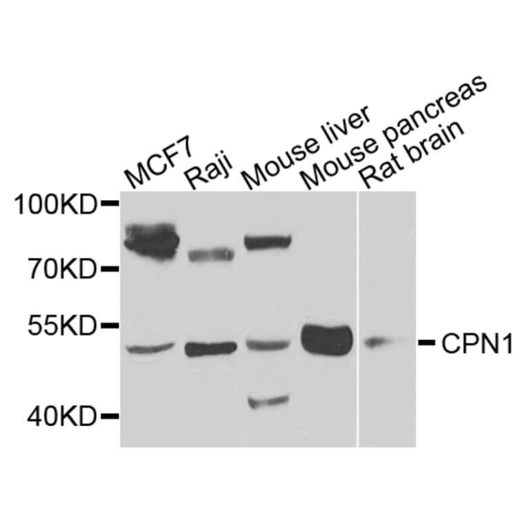 Western Blot - Anti-CPN1 Antibody (A7887) - Antibodies.com