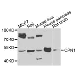 Western Blot - Anti-CPN1 Antibody (A7887) - Antibodies.com