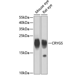 Western Blot - Anti-Beta crystallin S Antibody (A15957) - Antibodies.com