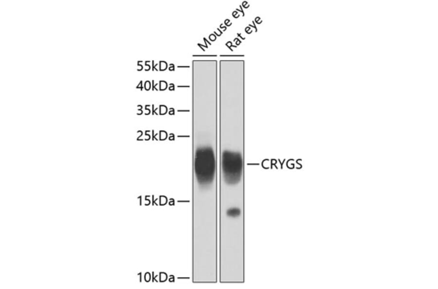 Western Blot - Anti-Beta crystallin S Antibody (A15957) - Antibodies.com