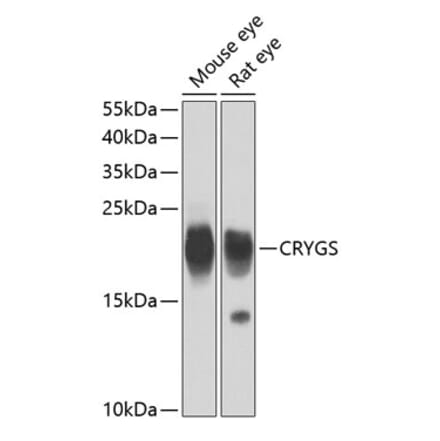 Western Blot - Anti-Beta crystallin S Antibody (A15957) - Antibodies.com