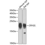 Western Blot - Anti-Beta crystallin S Antibody (A15957) - Antibodies.com