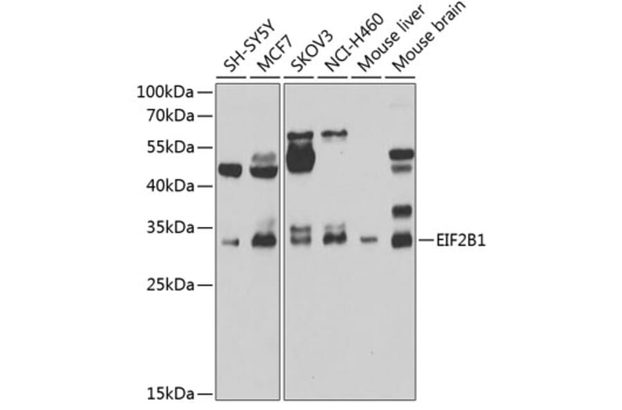 Western Blot - Anti-EIF2B1 Antibody (A15958) - Antibodies.com