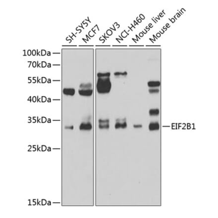 Western Blot - Anti-EIF2B1 Antibody (A15958) - Antibodies.com