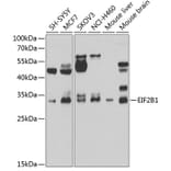 Western Blot - Anti-EIF2B1 Antibody (A15958) - Antibodies.com