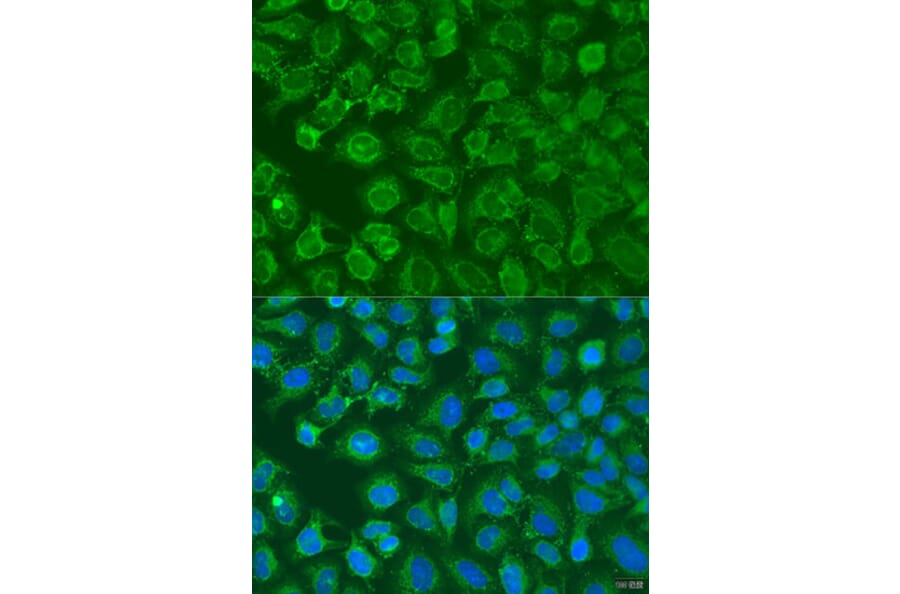 Immunofluorescence - Anti-EIF2B1 Antibody (A15958) - Antibodies.com