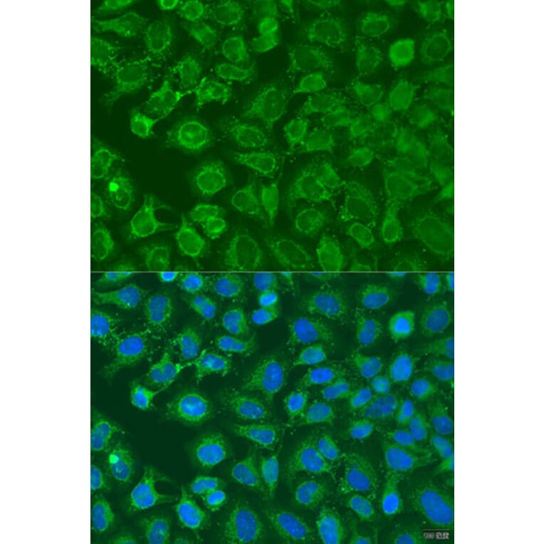 Immunofluorescence - Anti-EIF2B1 Antibody (A15958) - Antibodies.com