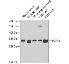 Western Blot - Anti-FGF13 Antibody (A15960) - Antibodies.com