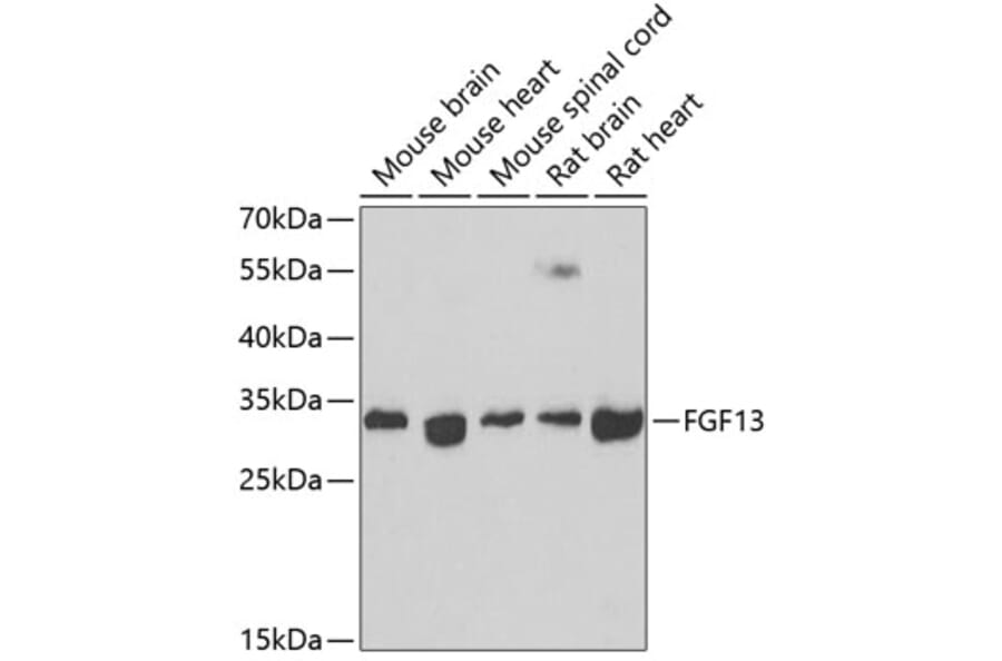 Western Blot - Anti-FGF13 Antibody (A15960) - Antibodies.com