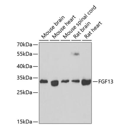 Western Blot - Anti-FGF13 Antibody (A15960) - Antibodies.com