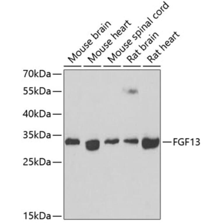 Western Blot - Anti-FGF13 Antibody (A15960) - Antibodies.com
