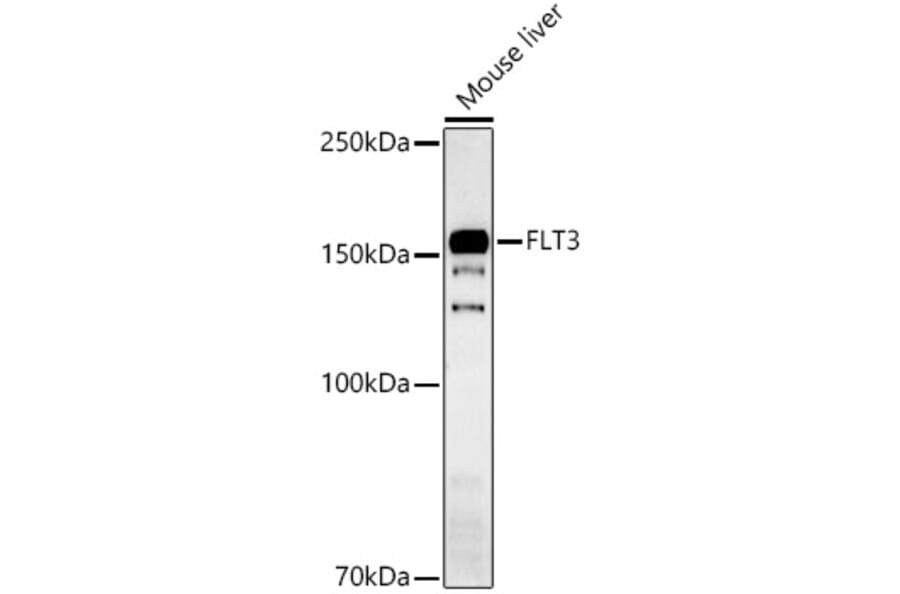 Western Blot - Anti-Flt3 / CD135 Antibody (A15961) - Antibodies.com