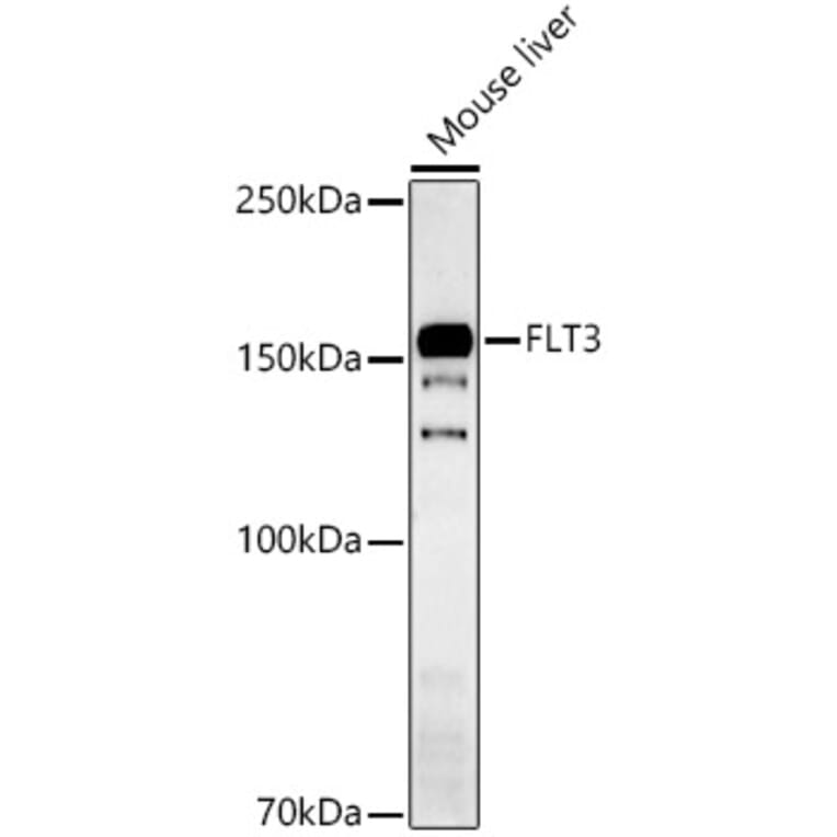 Western Blot - Anti-Flt3 / CD135 Antibody (A15961) - Antibodies.com