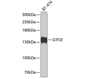 Western Blot - Anti-TFII I Antibody (A15962) - Antibodies.com