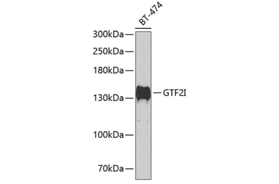 Western Blot - Anti-TFII I Antibody (A15962) - Antibodies.com