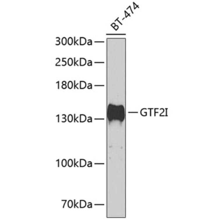 Western Blot - Anti-TFII I Antibody (A15962) - Antibodies.com