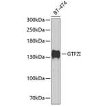 Western Blot - Anti-TFII I Antibody (A15962) - Antibodies.com