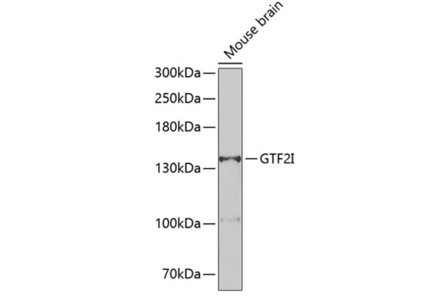 Western Blot - Anti-TFII I Antibody (A15962) - Antibodies.com