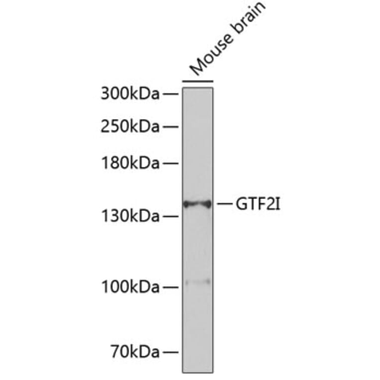 Western Blot - Anti-TFII I Antibody (A15962) - Antibodies.com
