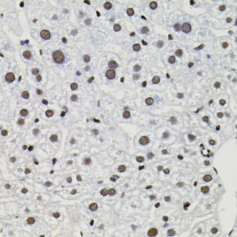 Immunohistochemistry - Anti-TFII I Antibody (A15962) - Antibodies.com