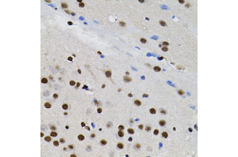 Immunohistochemistry - Anti-TFII I Antibody (A15962) - Antibodies.com