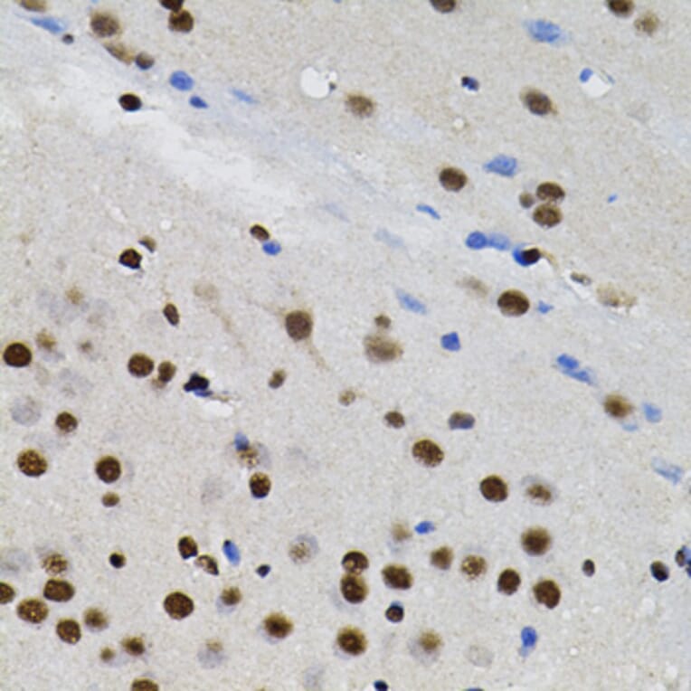 Immunohistochemistry - Anti-TFII I Antibody (A15962) - Antibodies.com