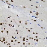 Immunohistochemistry - Anti-TFII I Antibody (A15962) - Antibodies.com