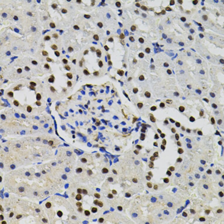 Immunohistochemistry - Anti-TFII I Antibody (A15962) - Antibodies.com