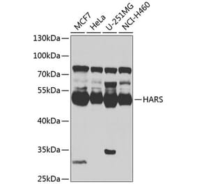 Western Blot - Anti-HARS Antibody (A15963) - Antibodies.com