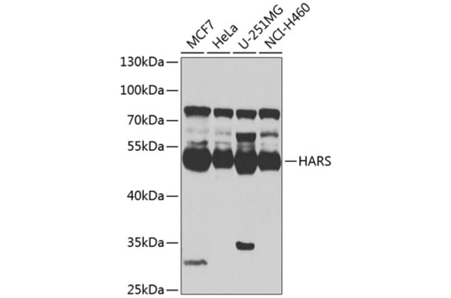 Western Blot - Anti-HARS Antibody (A15963) - Antibodies.com