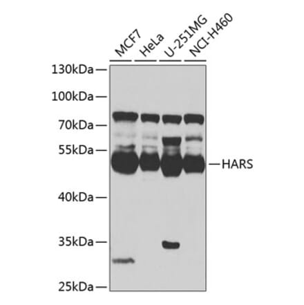 Western Blot - Anti-HARS Antibody (A15963) - Antibodies.com