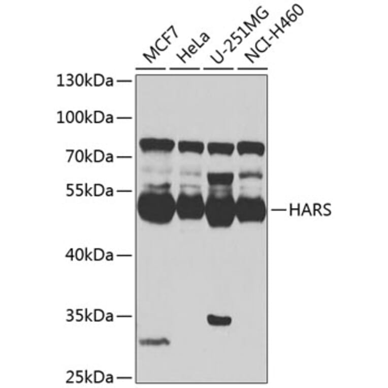 Western Blot - Anti-HARS Antibody (A15963) - Antibodies.com